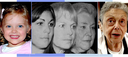 Aging