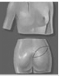 SGAP Flap