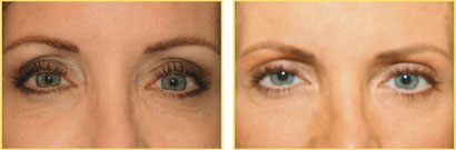 Eyebrows