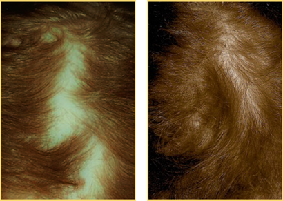 Before Folara and 12 weeks after starting Folara