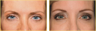 Eyebrows