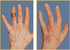 Hand Reconstruction