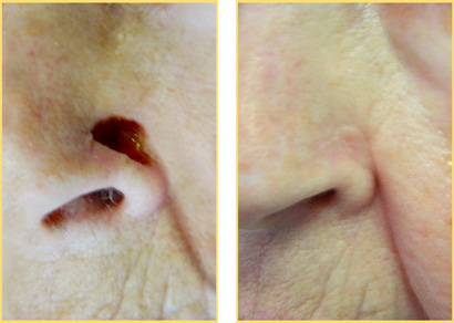Head-and-Neck-6