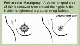 Donut nipple rings clearance