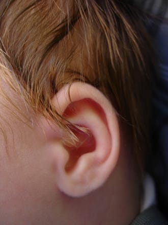From North Canton to Jamestown, Microtia Ear Surgery Changing Young Boys’ Lives
