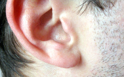 The Continued Rise in Ear Lobe Repair Surgeries