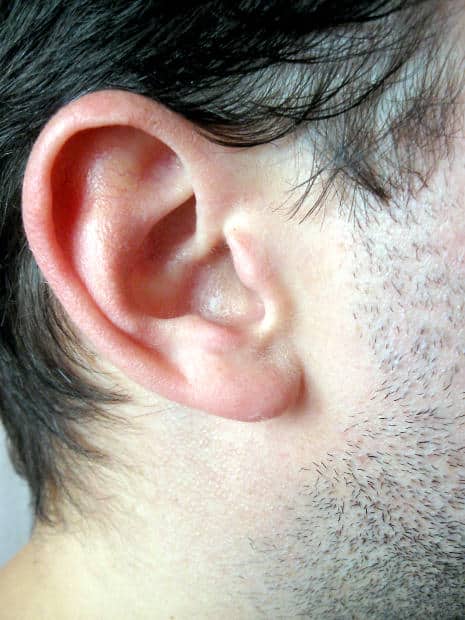 The Continued Rise in Ear Lobe Repair Surgeries