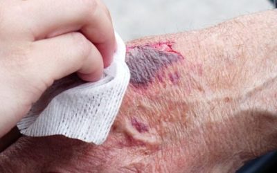 Reflecting on Wound Care Awareness Week
