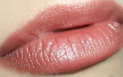 Tackling Cleft Lip Across the Globe
