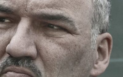 Gynecomastia in the Middle East