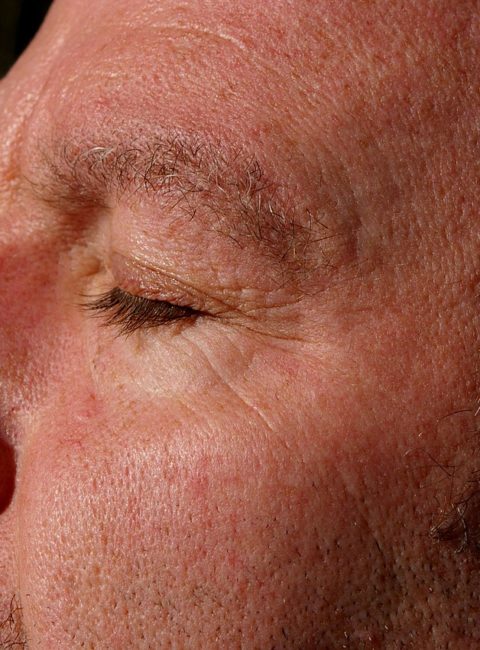 Man eye wrinkles