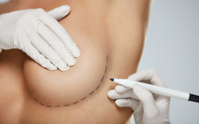 Preparación para la cirugía de aumento de senos