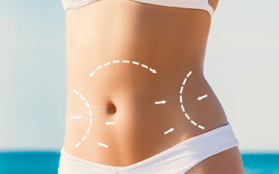 CoolSculpting vs Liposuction: Which One is Right For You?