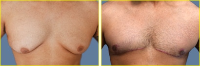 gyno0821frontb